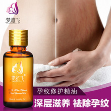 烧水喝和买桶/瓶装水喝 哪个更健康：研究结果让你看完后怕